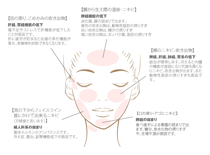 ニキビ 皮脂でお悩みの方 お悩み相談 ホワイトリリー化粧品